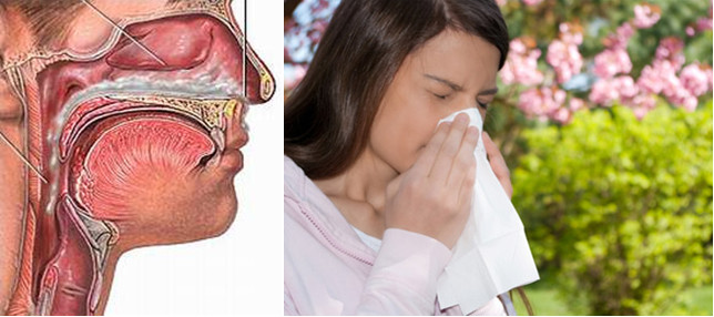 Nguyên nhân gây viêm mũi dị ứng 1